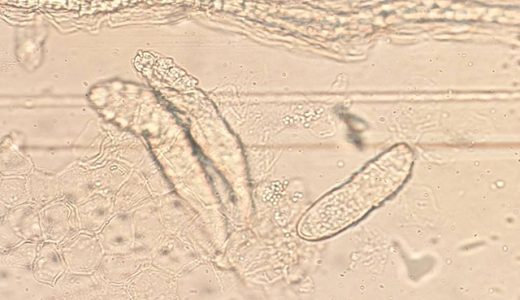 「毛包虫」ってご存知ですか？